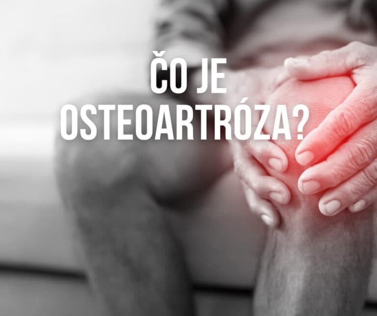Čo je osteoartróza?
